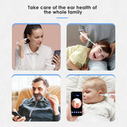 Ear Cleaner, Smart VisualSmart Visual Ear Cleaner - Premium  from Nobles Store - Just $42.70! Shop now at Nobles Store