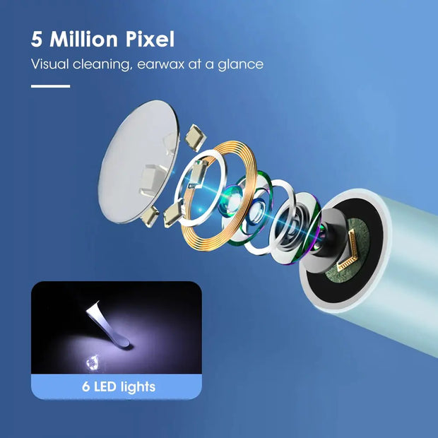 Ear Cleaner, Smart VisualSmart Visual Ear Cleaner - Premium  from Nobles Store - Just $42.70! Shop now at Nobles Store